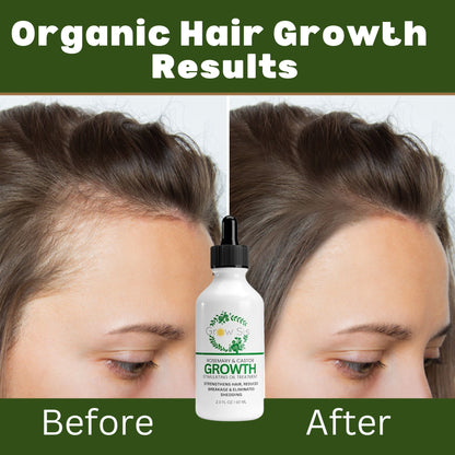 Advance Hair Growth Oil - Natural Growth Serum for Thicker  Longer Hair