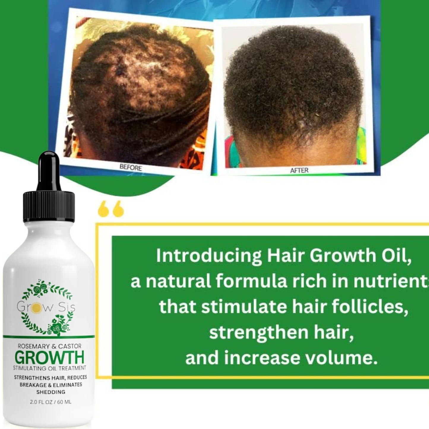 Advance Hair Growth Oil - Natural Growth Serum for Thicker  Longer Hair