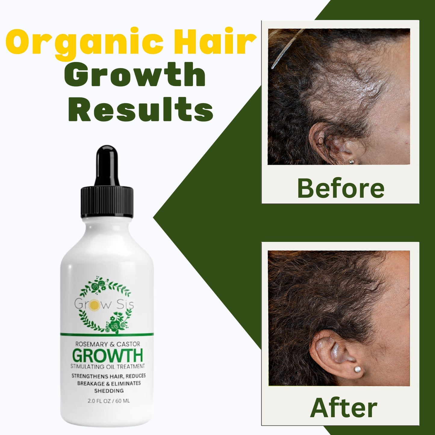 Advance Hair Growth Oil - Natural Growth Serum for Thicker  Longer Hair