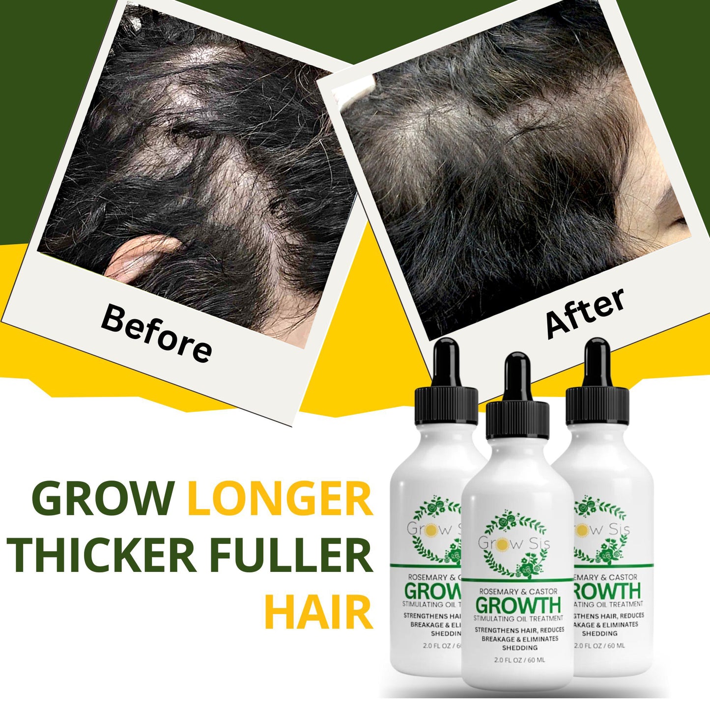 Advance Hair Growth Oil - Natural Growth Serum for Thicker  Longer Hair