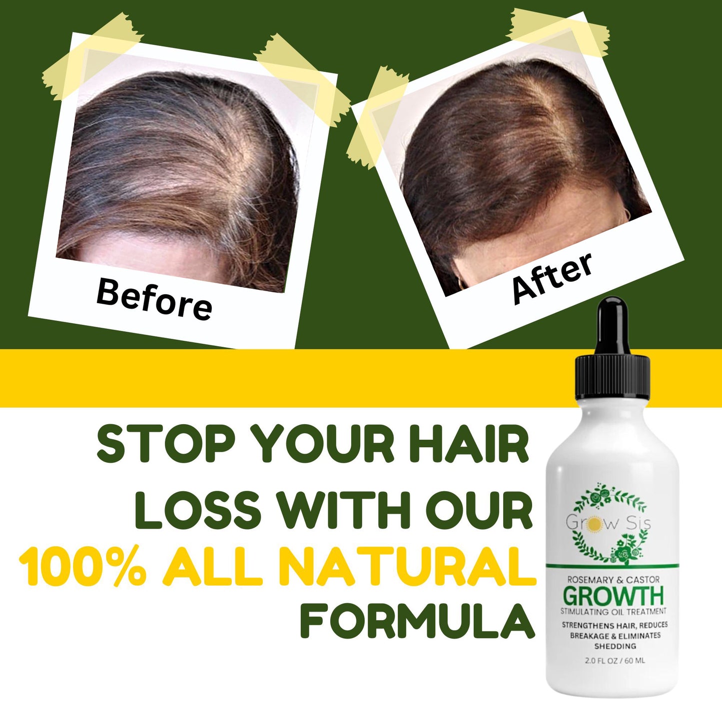 Advance Hair Growth Oil - Natural Growth Serum for Thicker  Longer Hair